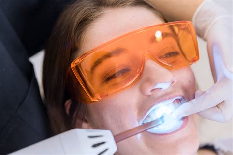 Laser Tooth Whitening How Is It Done Marchwood Dental Clinic Kanata
