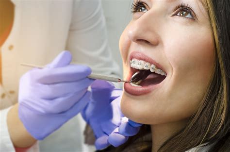 Orthodontists Associates Of Wny Free Orthodontic Consultations