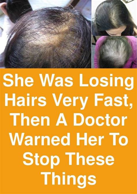 She Was Losing Hairs Very Fast Then A Doctor Warned Her To Stop These