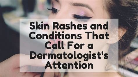 Skin Rashes And Conditions That Call For A Dermatologists Attention