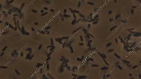 E Coli Bacteria Microscopy Stock Video Clip K0069607 Science