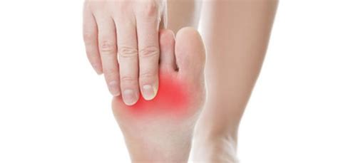 Ball Of Foot Pain Kensington Physio And Sports Medicine