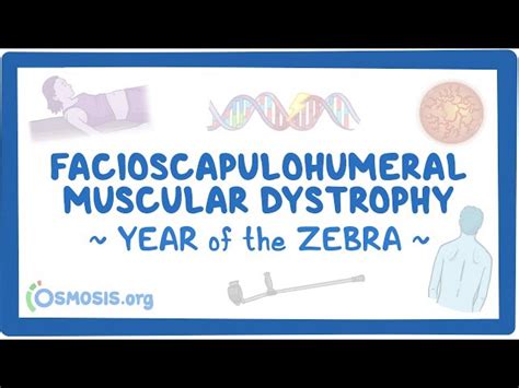 Rare Disease Education Facioscapulohumeral Muscular Dystrophy