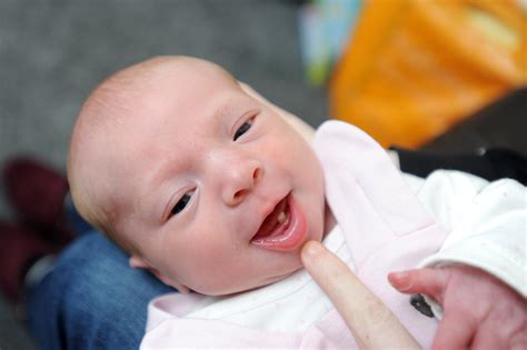 Pictures Of Babies Born With Teeth Teethwalls
