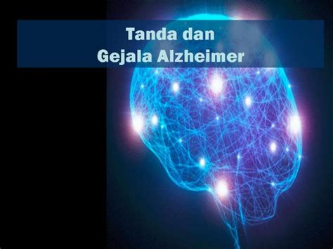 Tanda Dan Beberapa Gejala Penyakit Alzheimer Perlu Diwaspadai YSalma
