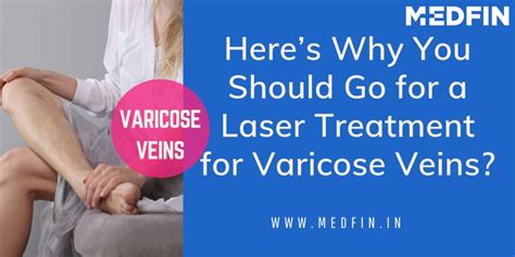 Heres Why You Should Go For A Laser Treatment For Varicose Veins