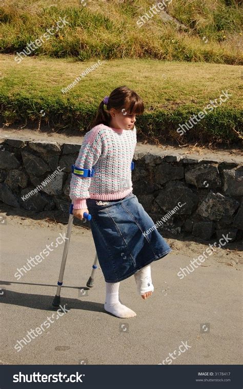 Little Girlwith Leg Plaster Using Crutches Stock Photo 3178417