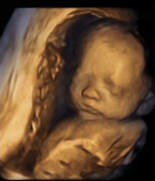We got a 26 week 3d/4d ultrasound! Our Little Worm: 25 weeks 3d ultrasound!