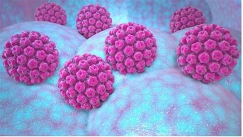 Infectia Cu Human Papillomavirus HPV Vestmed Resita