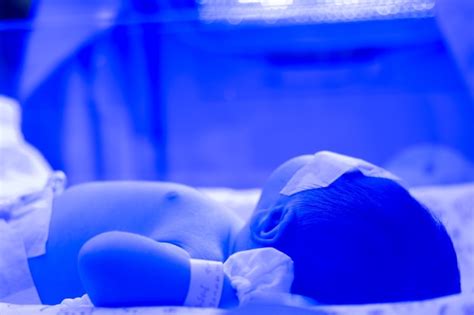 Newborn Baby With Hyperbilirubinemia Neonatal Jaundice Under Blue Uv