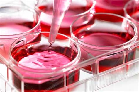 Systematic review of factors influencing extracellular vesicle yield