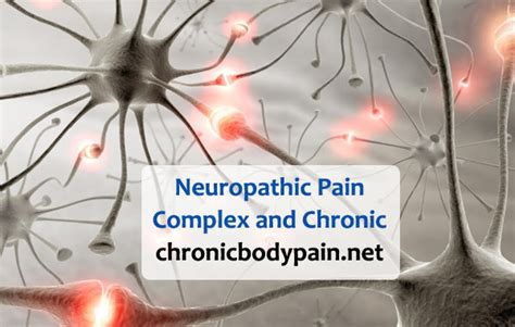 Neuropathic Pain Complex And Chronic Chronic Body Pain