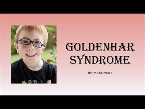 Goldenhar Syndrome Clinical Features Investigation Management YouTube