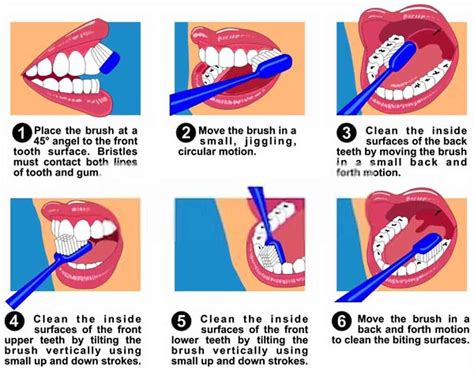 What Is Dental Hygiene Tulsa Dental Center
