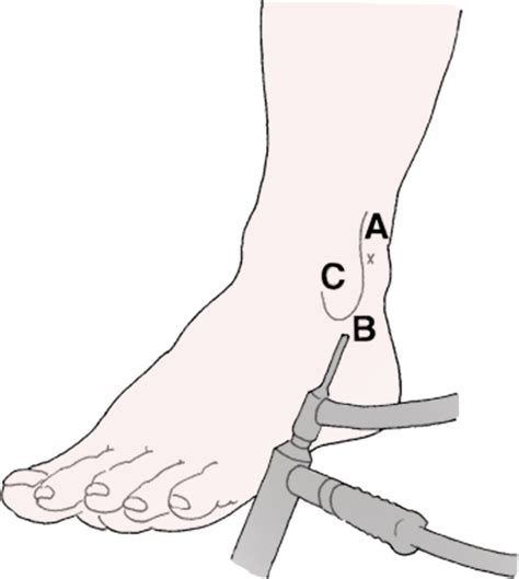 Ankle Drawing At Getdrawings Free Download