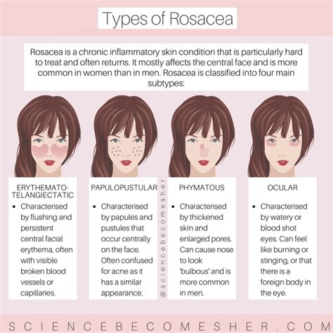What Is Rosacea Symptoms Causes And Treatments Science Becomes Her