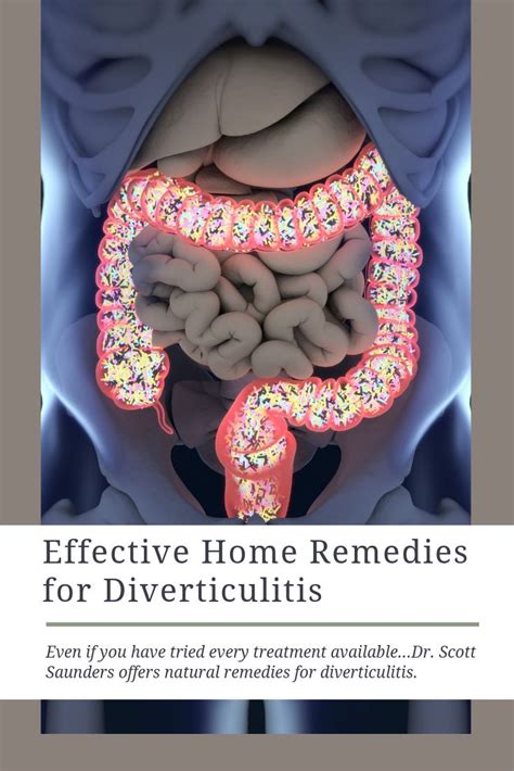 The Consequence Of Diverticulitis Is Abdominal Complications But