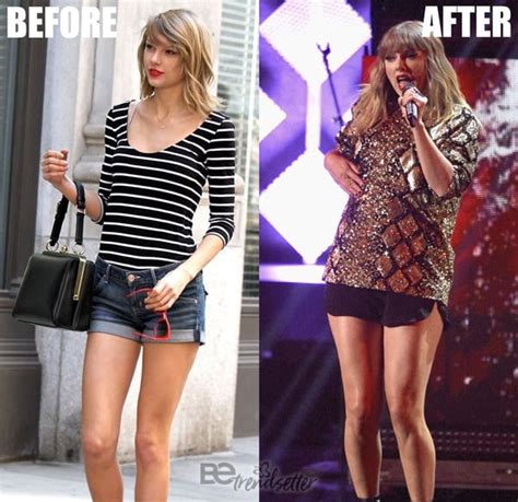 Taylor Swift Before And After Plastic Surgery Butt