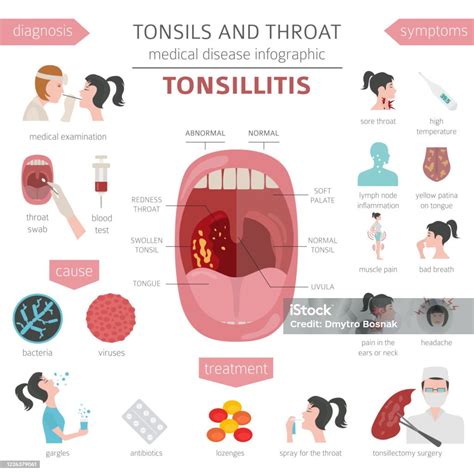 Tonsillen Und Halskrankheiten Tonsillitis Symptome Behandlungssymbol