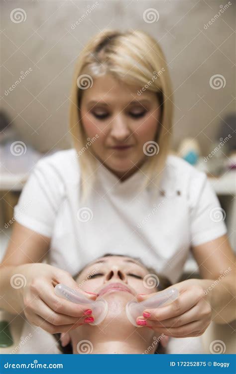 Cup Applied To Facial Skin Of A Female Patient As Part Of The Traditional Method Of Cupping