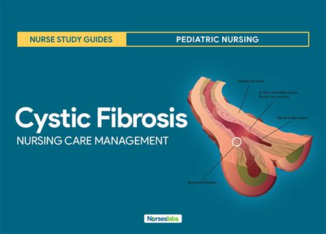Cystic Fibrosis Nursing Care Management Study Guide
