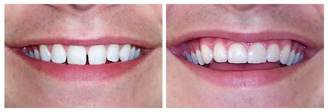 Cosmetic Dentistry Dental Designs Of Savannah