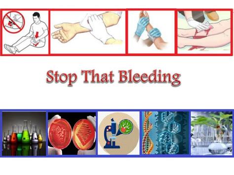 Ppt Stop That Bleeding Powerpoint Presentation Free Download Id