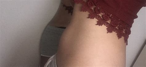 Wann bekommt man eine psychose? Sieht das aus nach einem babybauch? (Schwangerschaft ...