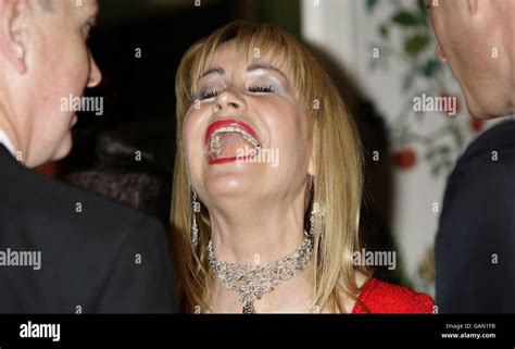 Sian Lloyd Laughs Hysterically Showing Her Fillings At The Fifi Uk