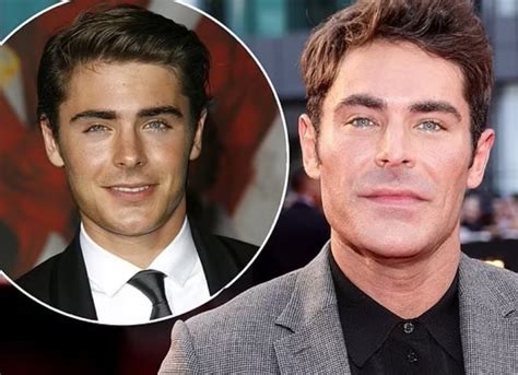 What Happened To Zac Efron Jaw Surgery Face Change And Plastic Surgery