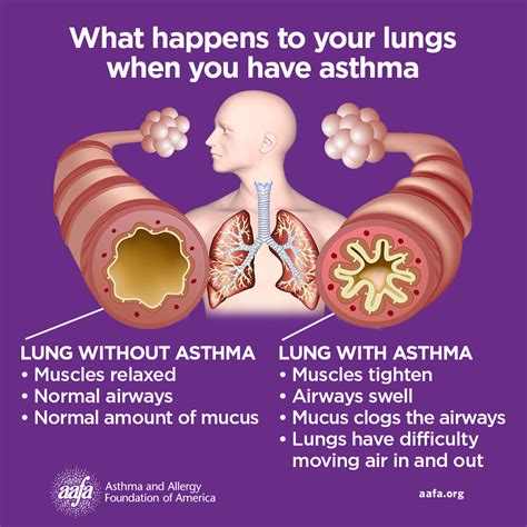 Asthma Attack Adults