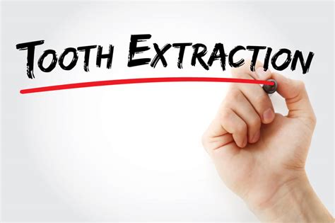 For multiple extractions, you should have soft foods only. When can i eat solid food after tooth extraction ...