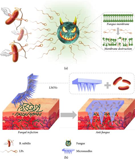 Living Bacterial Microneedles For Fungal Infection Treatment Research