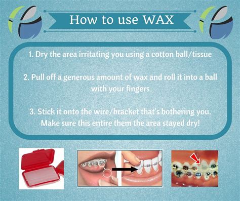 How To Use Orthodontic Wax For Braces How To Apply Dental Wax On Reverasite