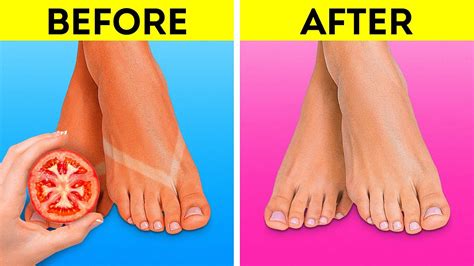 how to keep your feet healthy tips and hacks