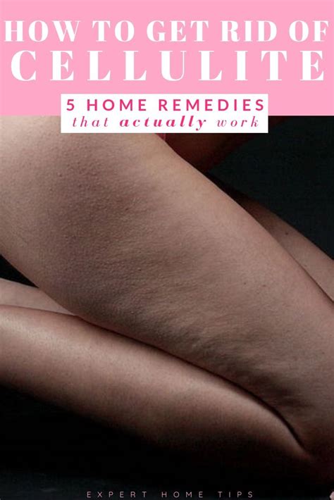 How To Get Rid Of Cellulite 5 Home Remedies That Actually Work Expert Home Tips