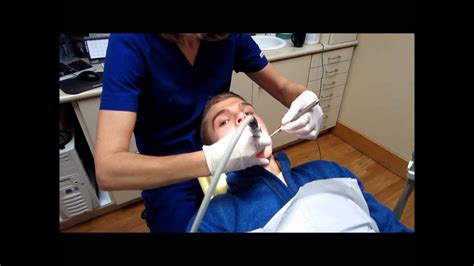 first smoothest teeth in the world tommy at the dentist getting his teeth cleaned youtube