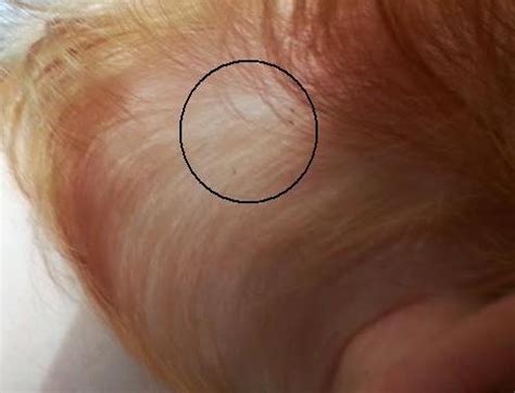Note that the cdc says lice may look darker on people with dark hair. The Brick Castle: Head Lice for the uninitiated.