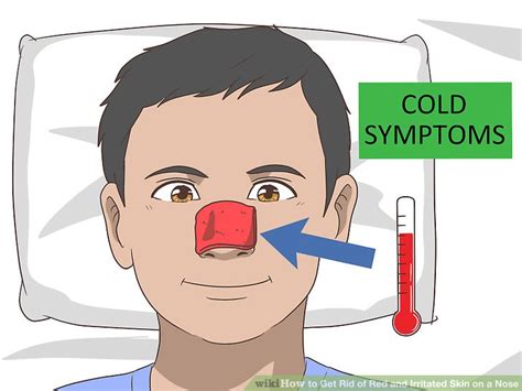 3 Ways To Get Rid Of Red And Irritated Skin On A Nose Wikihow