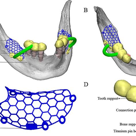 Pdf The Effect Of Bone Defect Size On The 3d Accuracy Of Alveolar