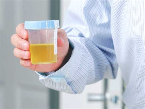 Epithelial Cells In Urine Types Test Results Causes And More