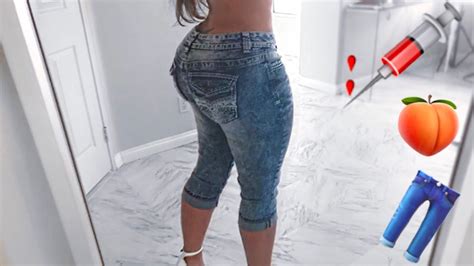 Brazilian Butt Lift Misssperu Youtube
