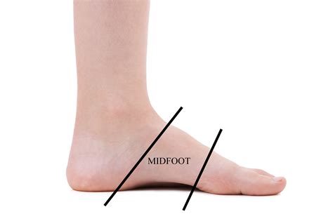 Midfoot Arch Pain Ankle Foot And Orthotic Centre