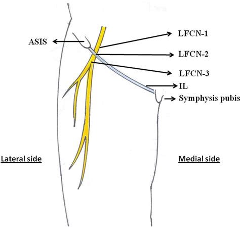 Femoral Nerve Inguinal Ligament