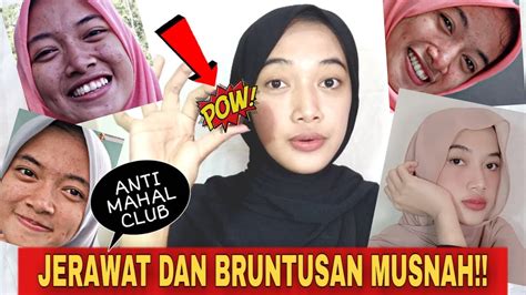 Jika anda mencari cara menghilangkan jerawat dengan segera, cukup gunakan madu yang mudah sekali ditemukan. CARA MENGHILANGKAN JERAWAT DAN BRUNTUSAN ANTI MAHAL-MAHAL ...