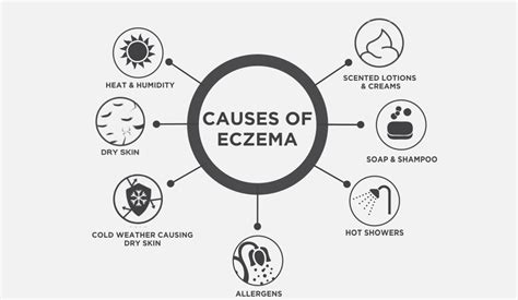 Eczema And Your Skin Epizone
