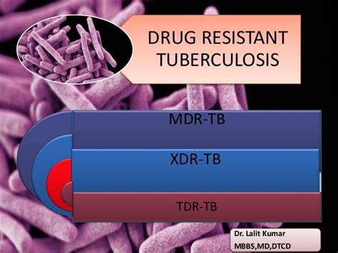 drug resistant tuberculosis diagnosis and treatment