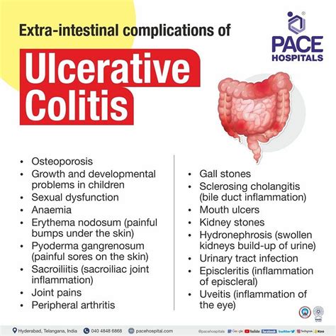 Ulcerative Colitis Symptoms Causes Types And Complications