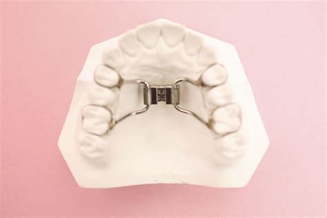 A Rpe Rapid Palatal Expander Is Often Used To Prevent Correct Or