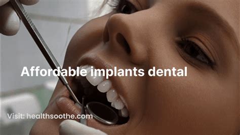 How To Get Dental Implants On A Budget